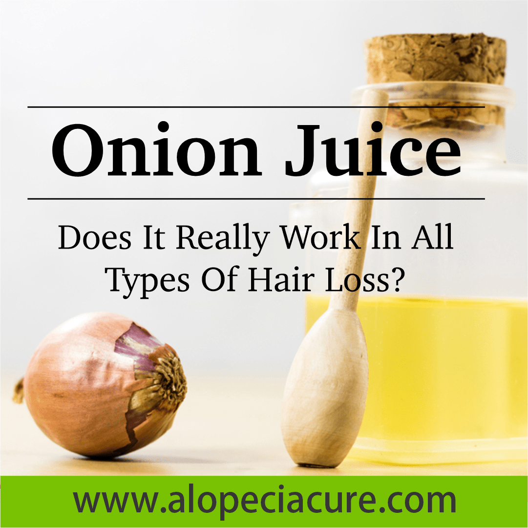 onion hair loss
